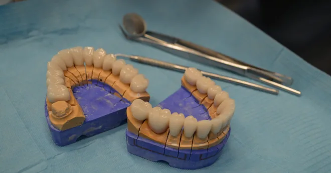 Due arcate dentali in ceramica su modelli, accanto agli strumenti