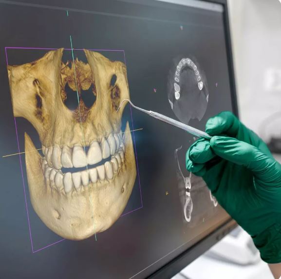 Scanner intraorale digitale e diagnostica 3D alla clinica dentale Gaia di Tirana