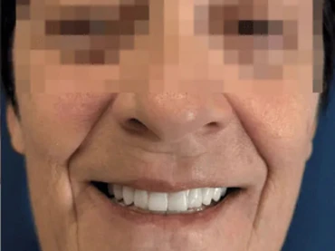 Dopo