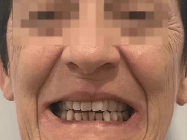 Prima