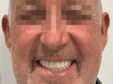 Dopo